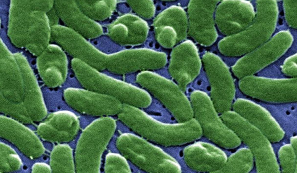 Microscopic image of V. vulnificus, with the bacterium is shown in green against a blue background.
