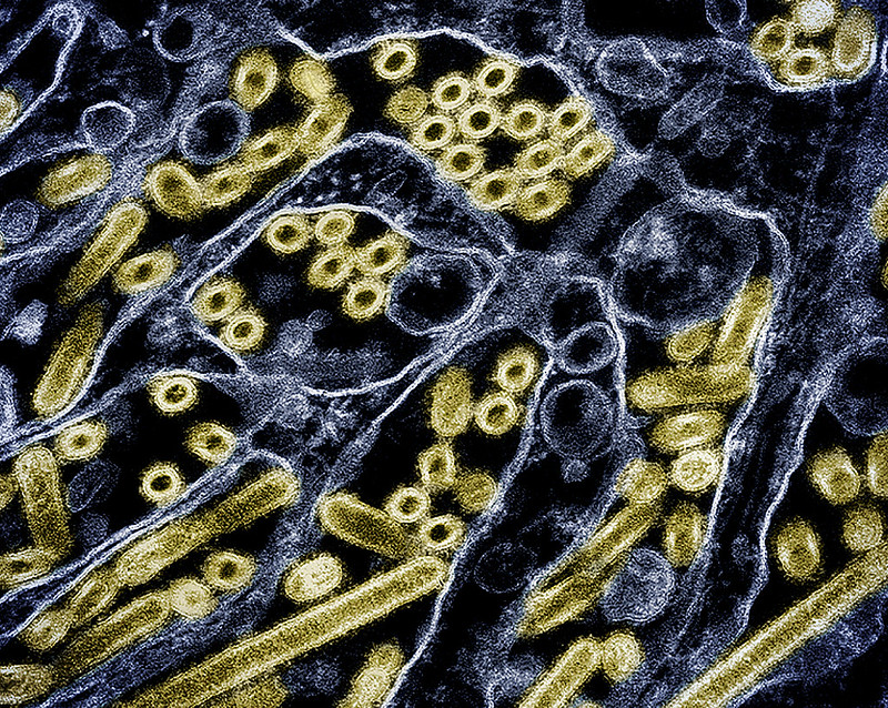 H5N1颗粒