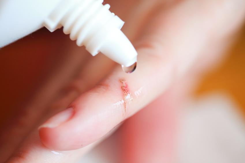 wound infection