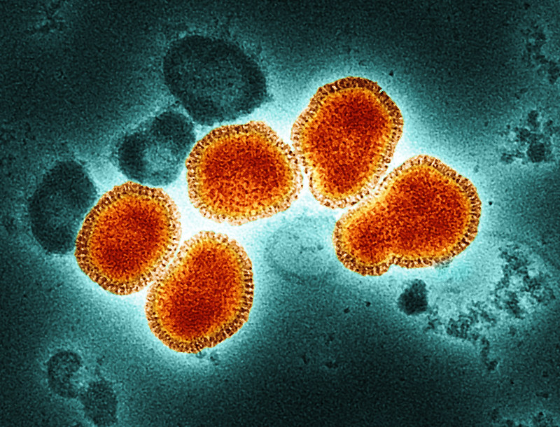 flu virus