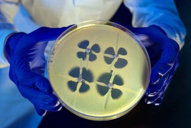 CRE bacteria on culture plate