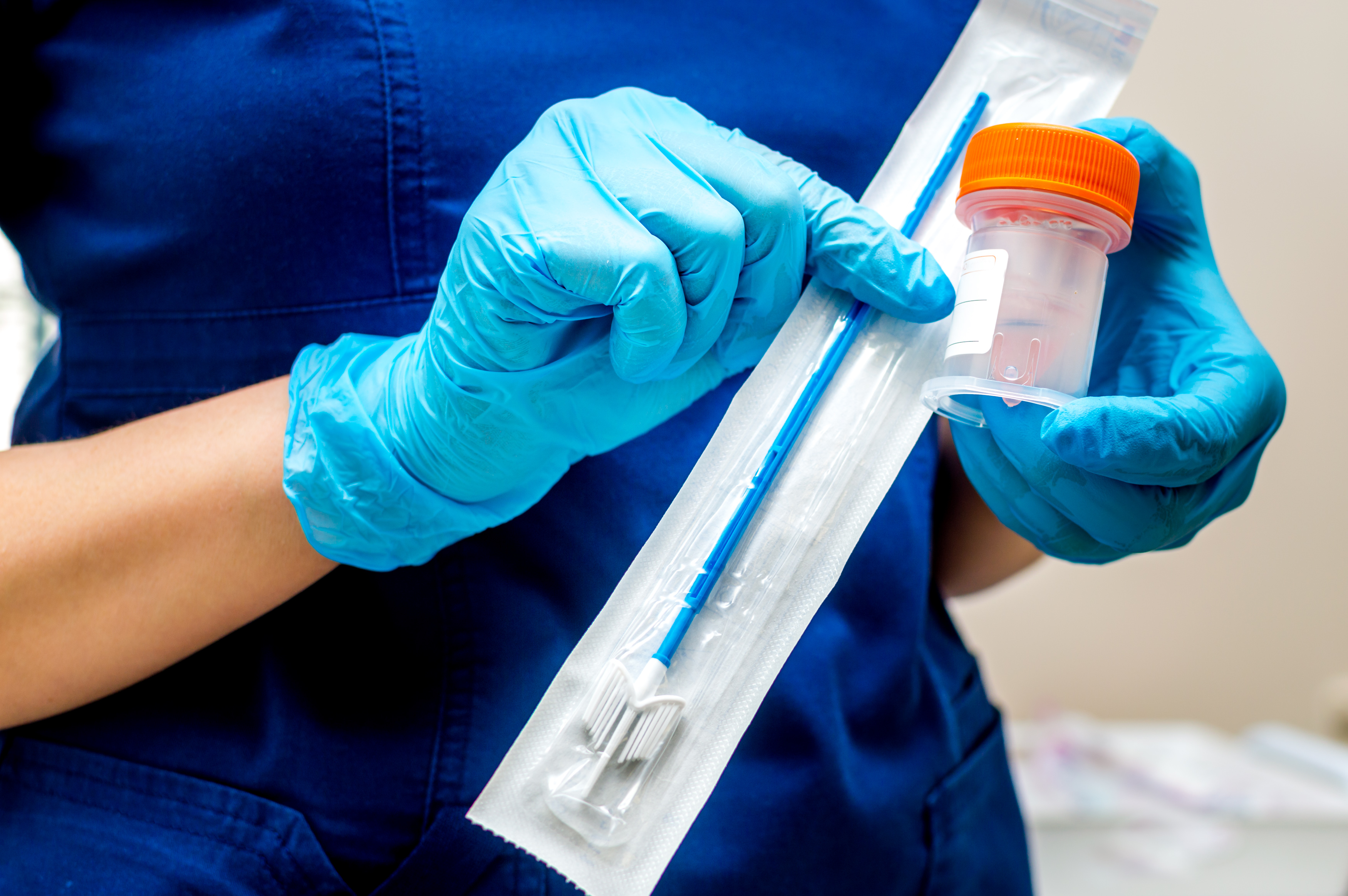 HPV test