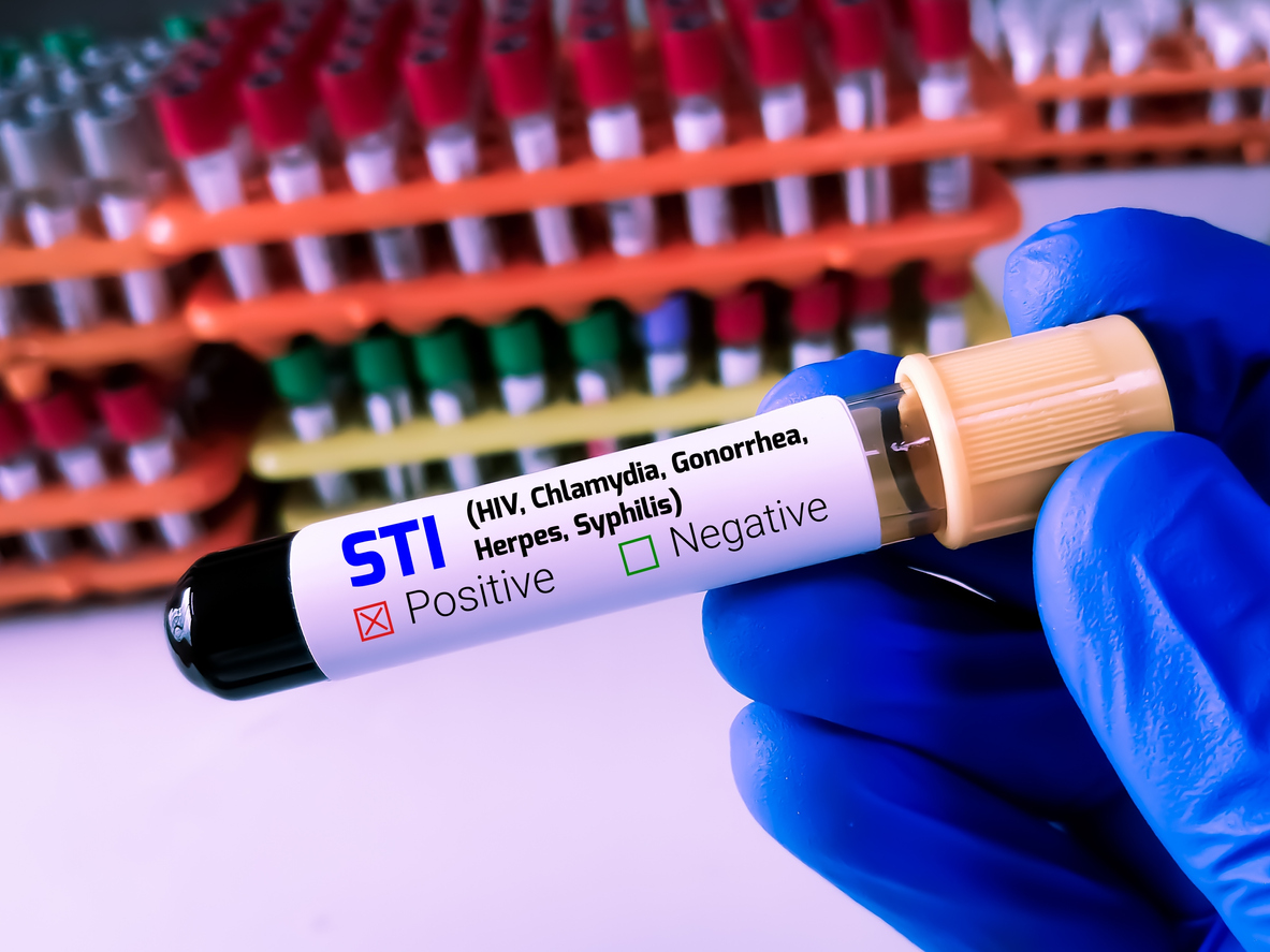 STD test