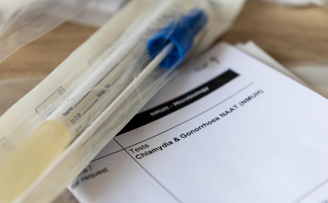 Chlamydia and gonorrhea test