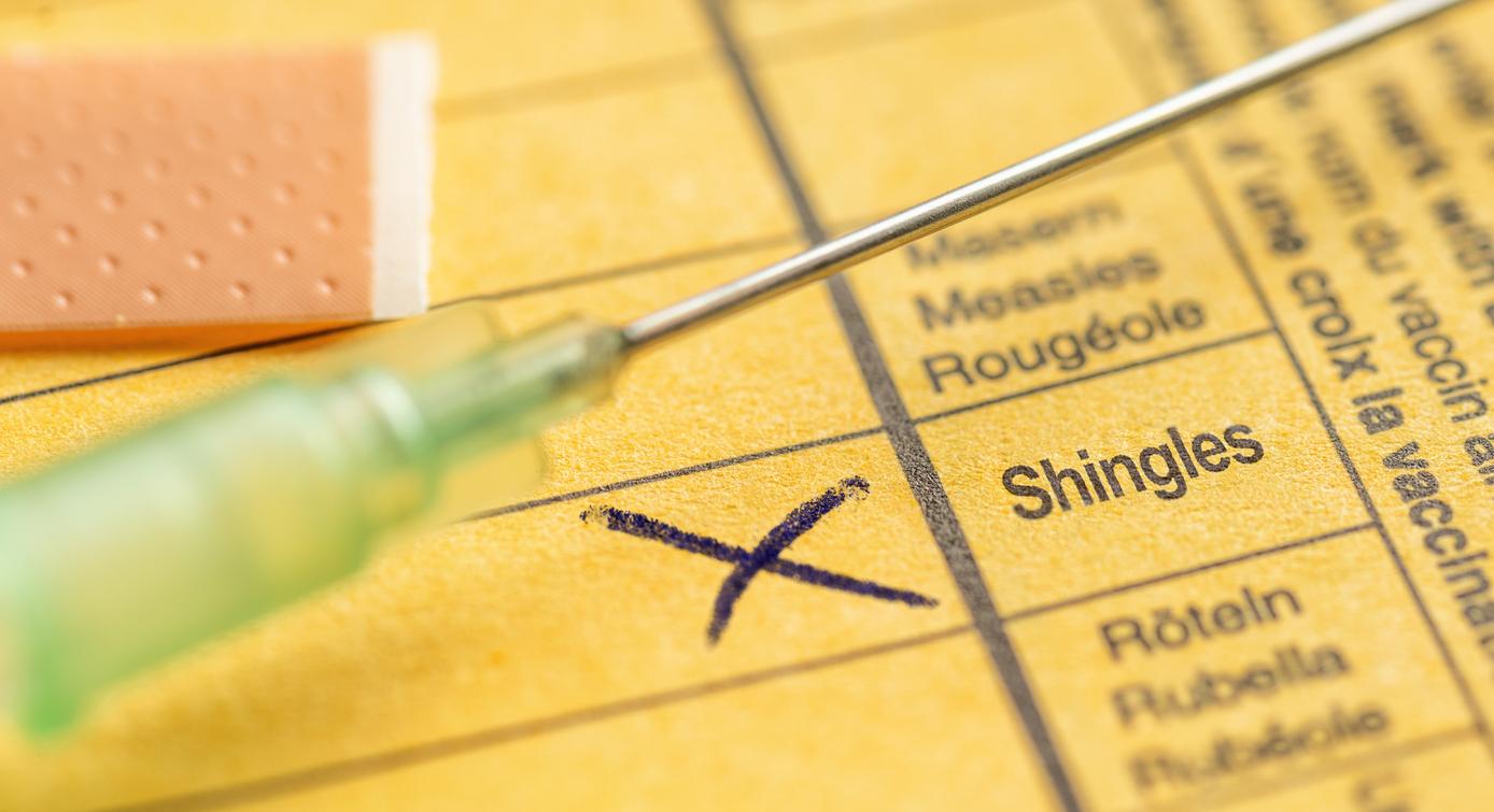 shingles