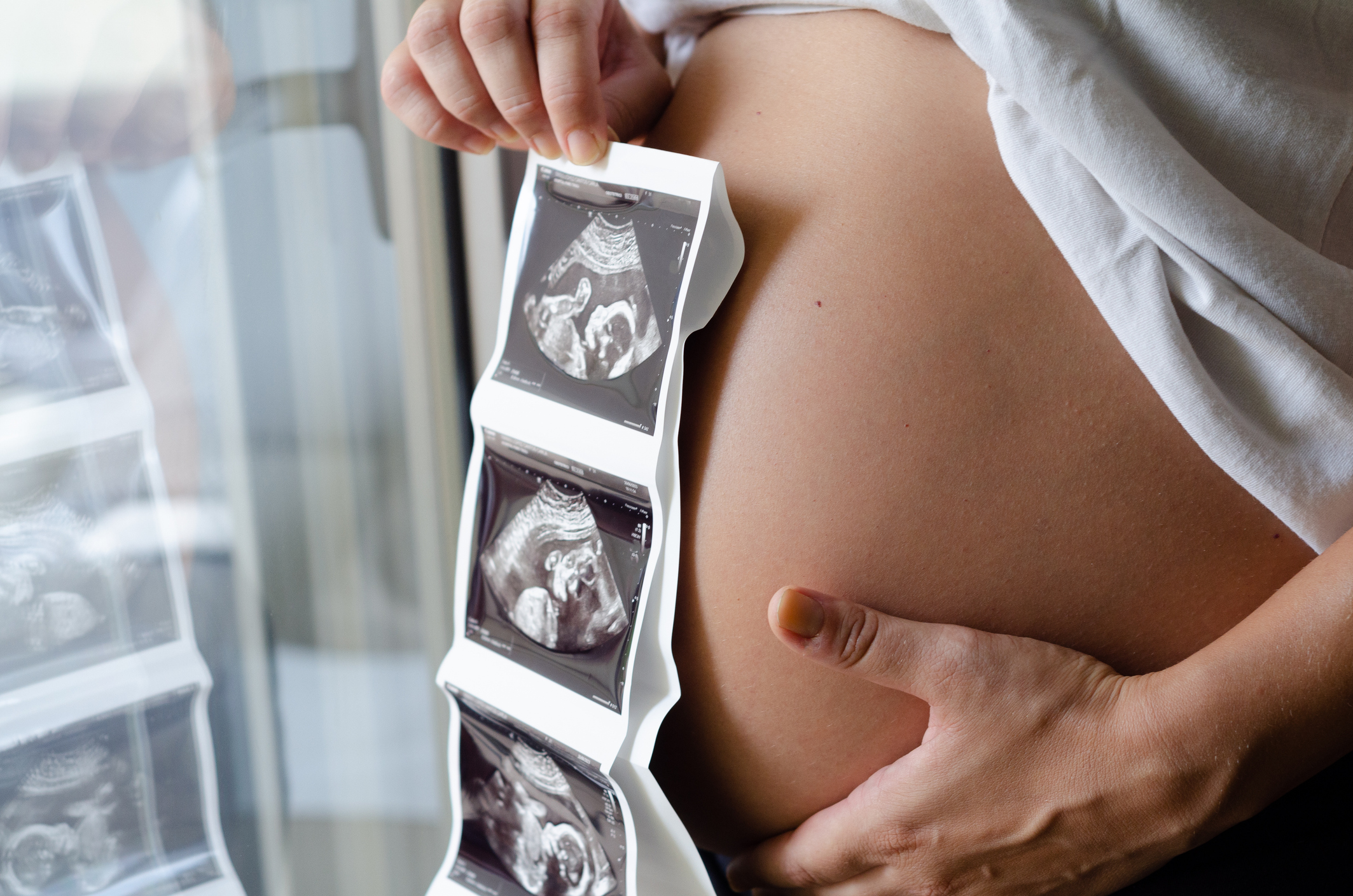 Pregnant person with light, peachy-tone skin, holding their round stomach with their left hand and three ultrasound images of their baby in their right hand.