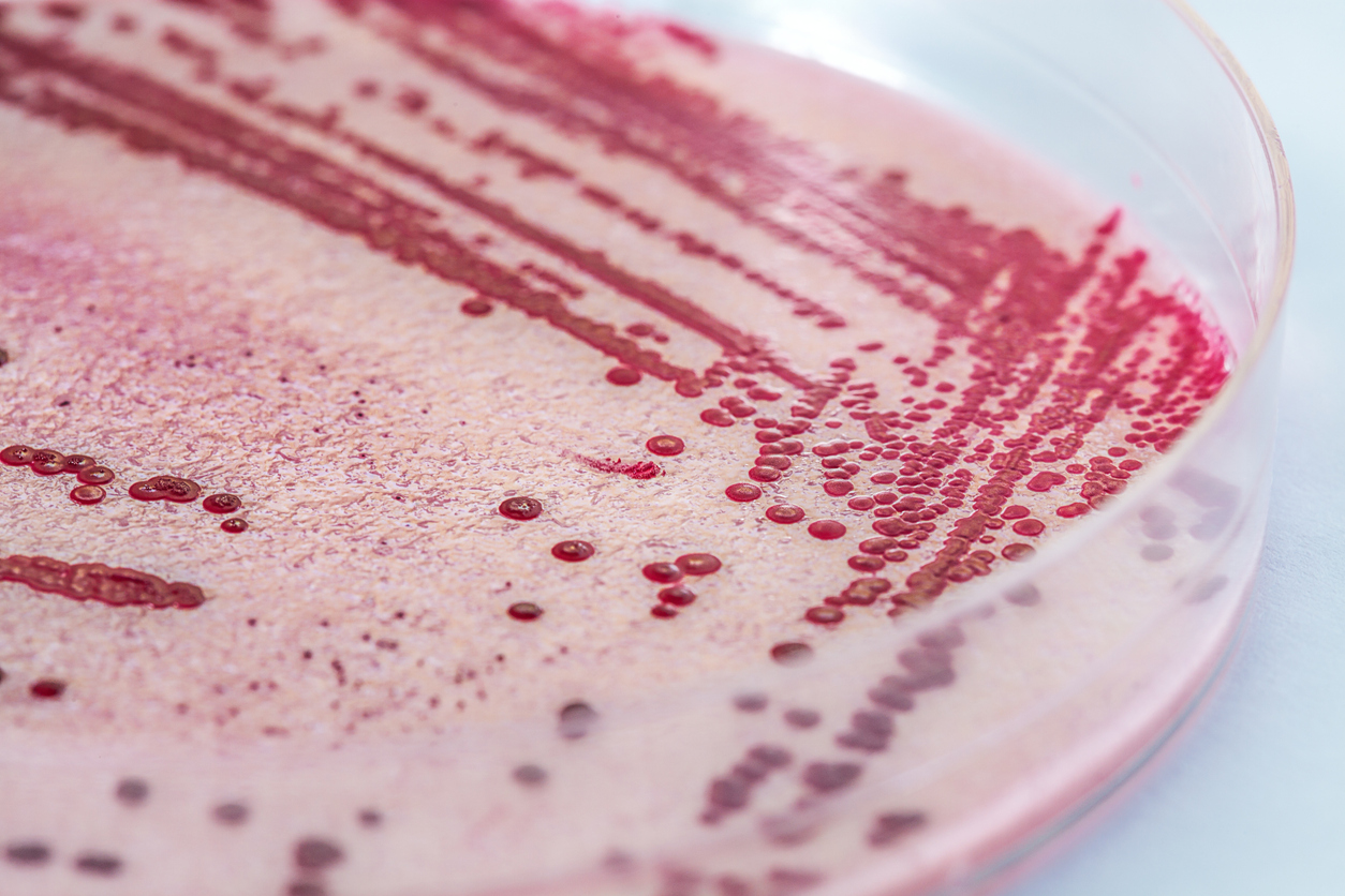 Listeria in petri dish