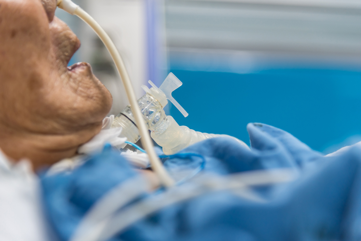 Patient on ventilator