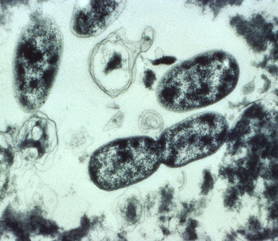 legionella
