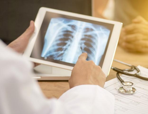 Doctor reviewing lung x-ray on tablet