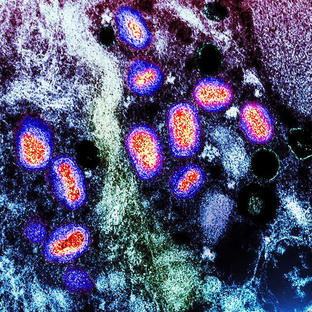 mpox blue red