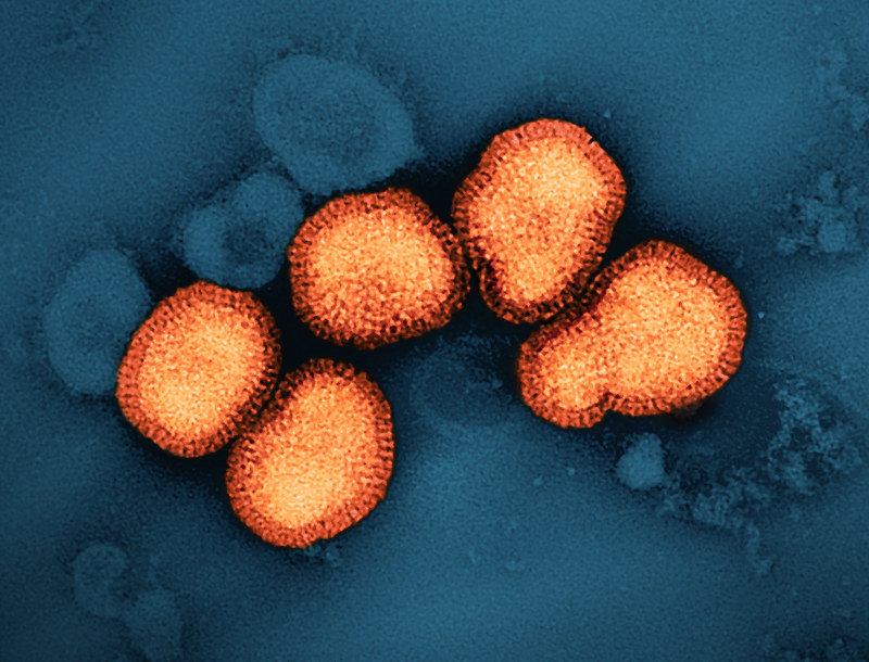 seasonal flu virus