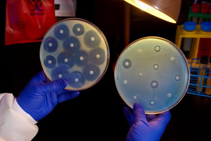 Carbapenem-resistant Enterobacterales