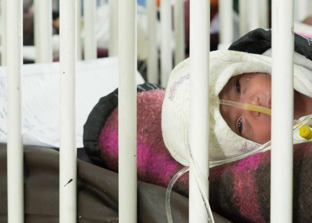 Baby with sepsis