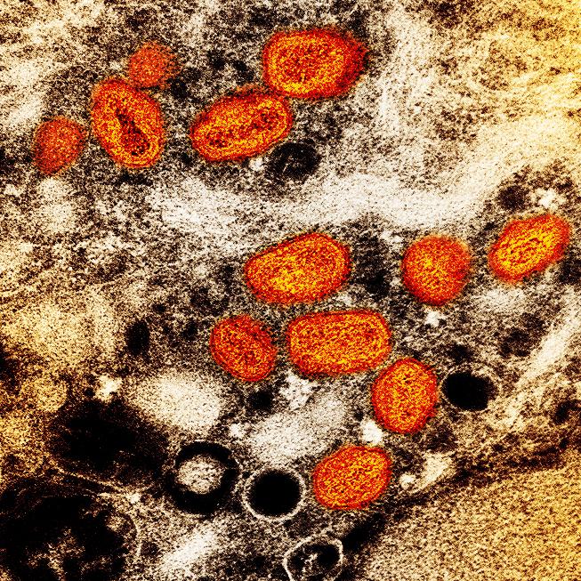 Mpox virus