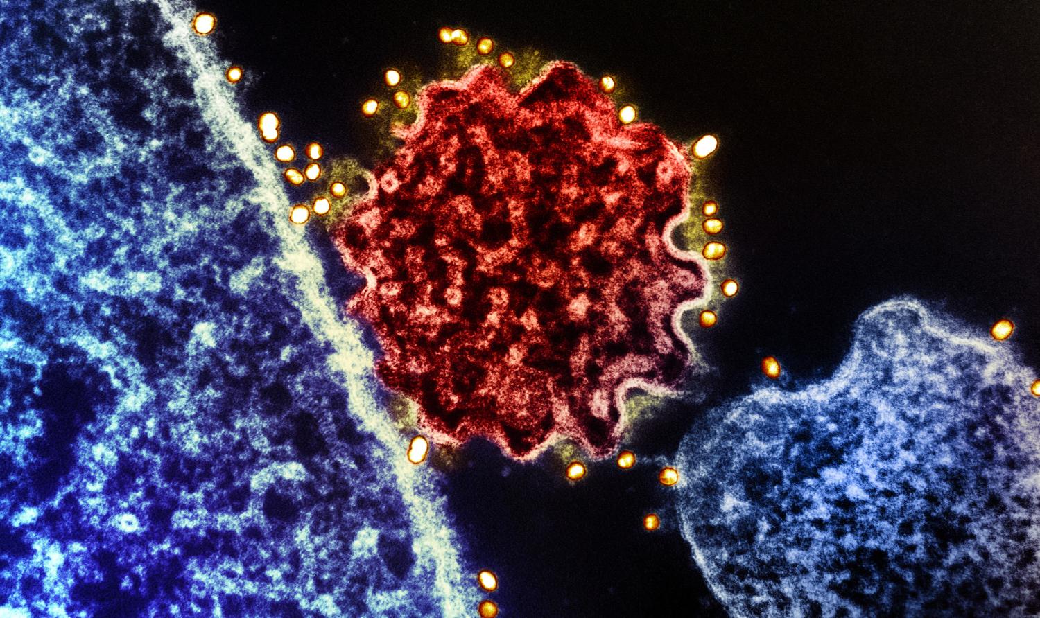 nipah virus particles