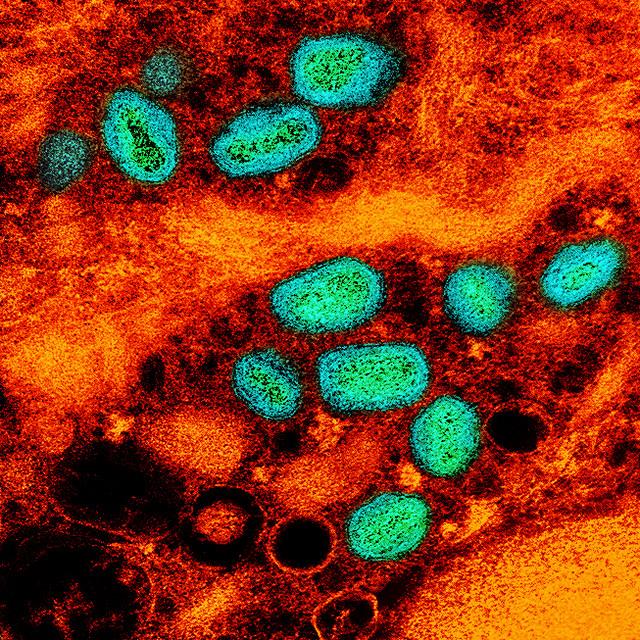 Mpox virus under the microscope