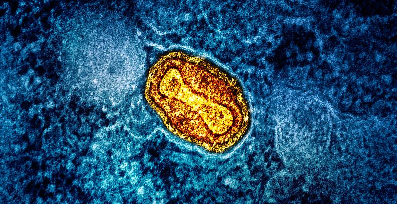 mpox cell