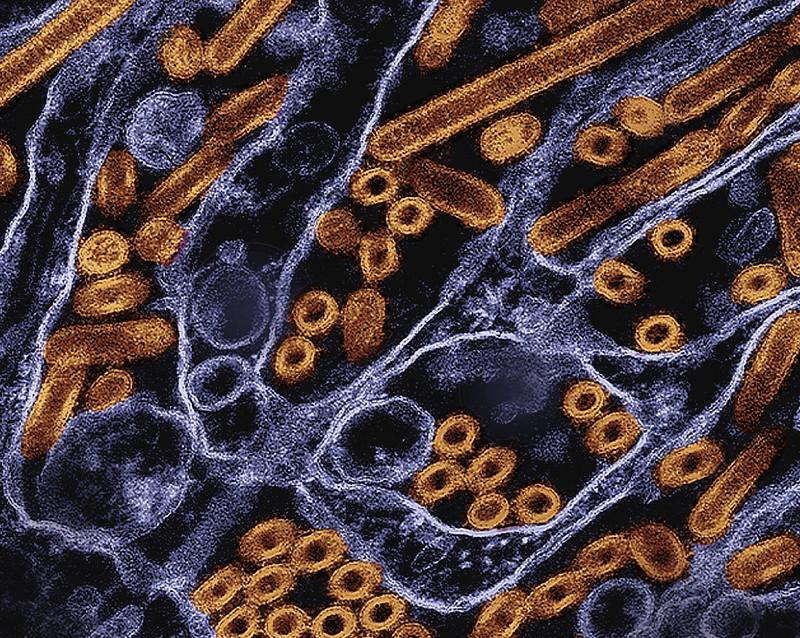 H5N1 virus