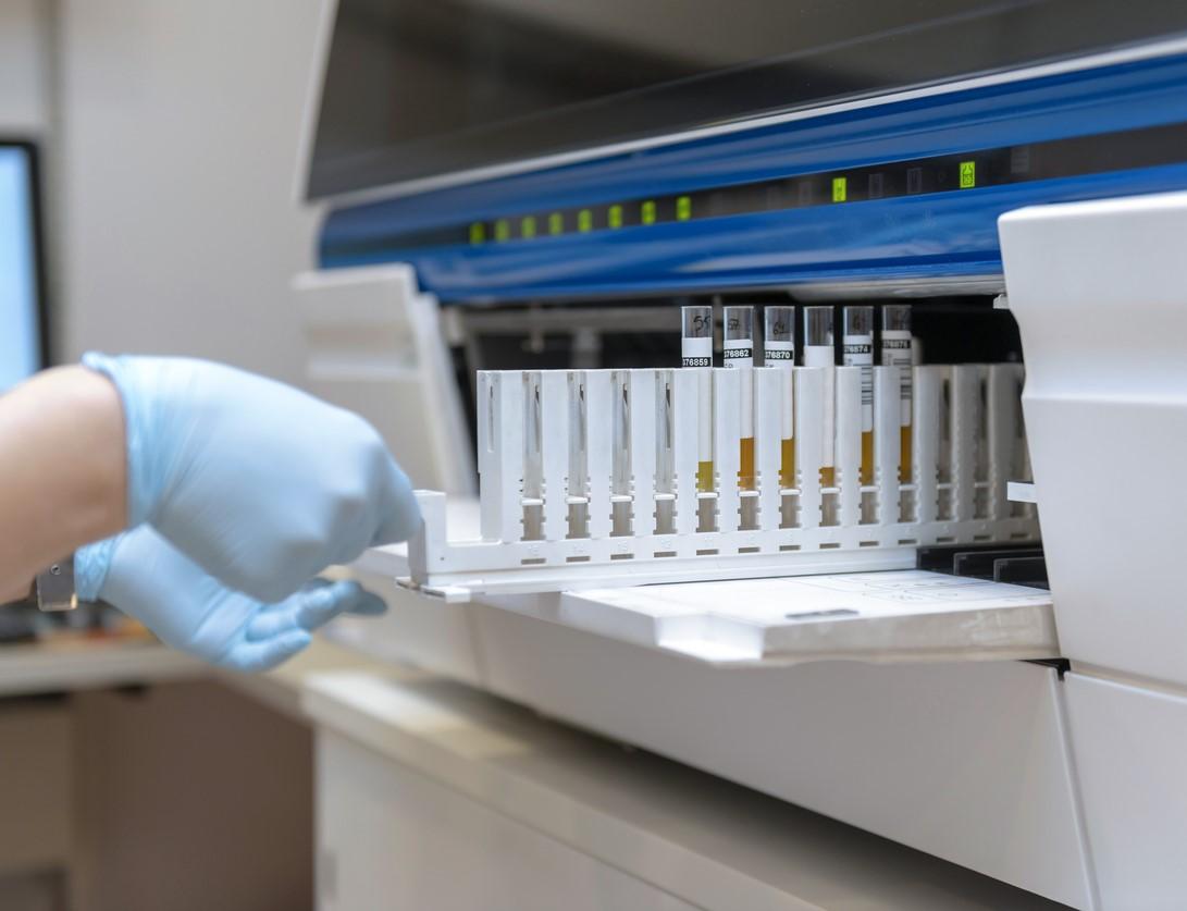 Analyzing urine samples