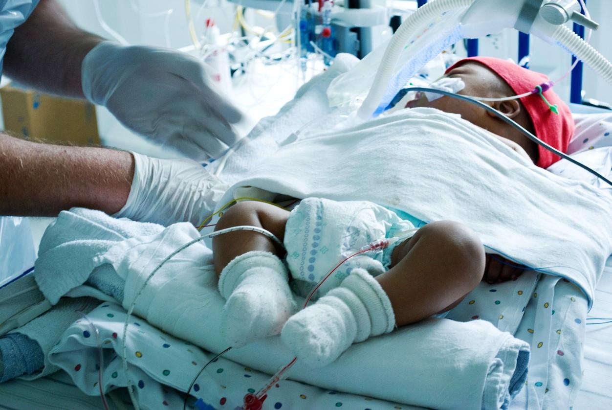 Baby on ventilator