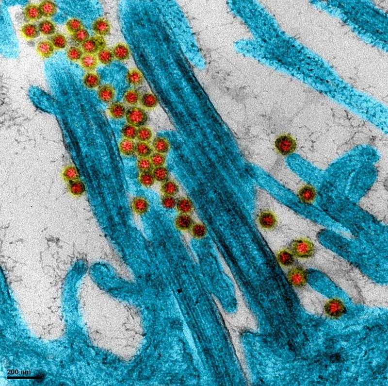 covid in epithelium