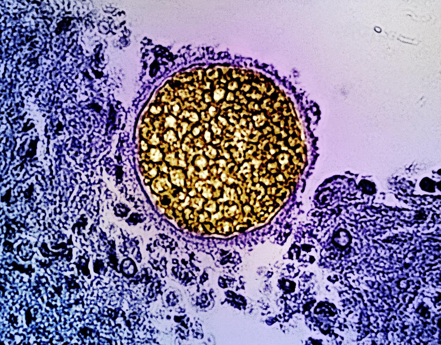 Coccidioides fungus 