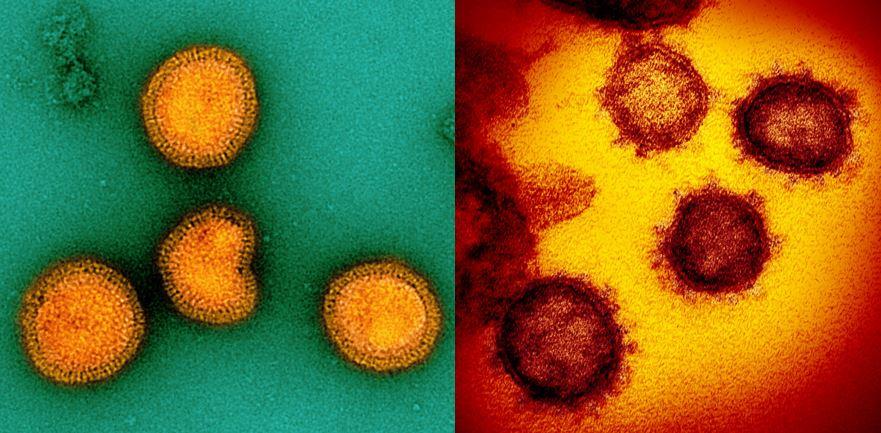 Influenza and SARS-CoV-2 viruses