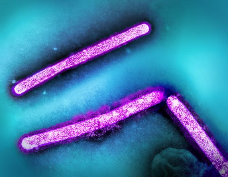 H5N1 particles