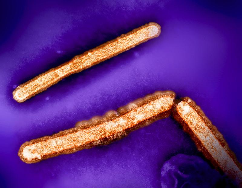 H5N1 virus