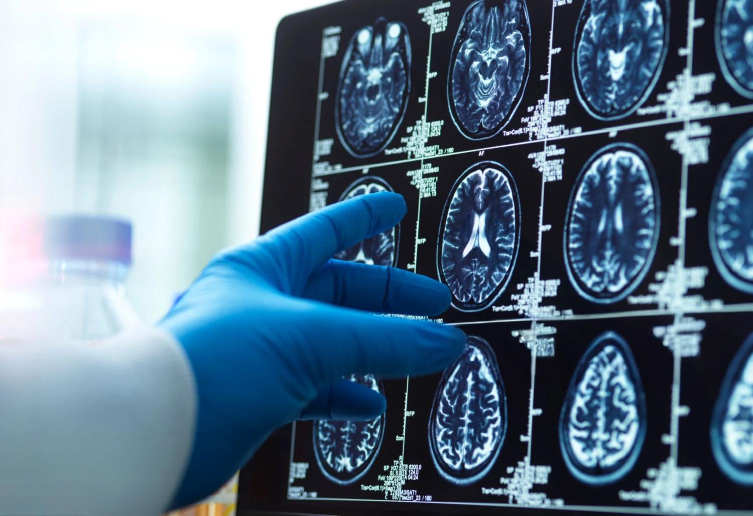 Magnetic resonance brain images
