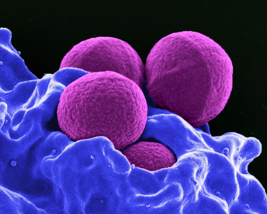 MRSA under the microscope