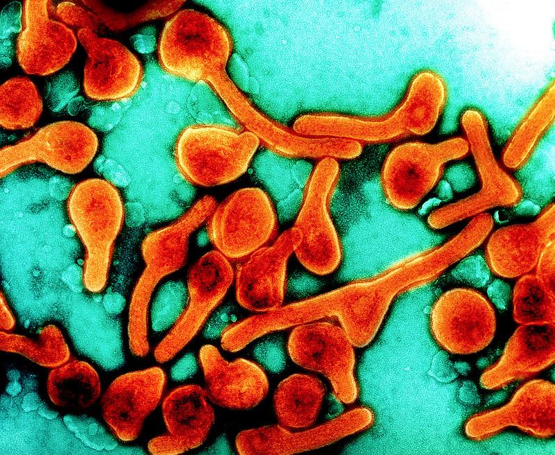 Marburg virus particles
