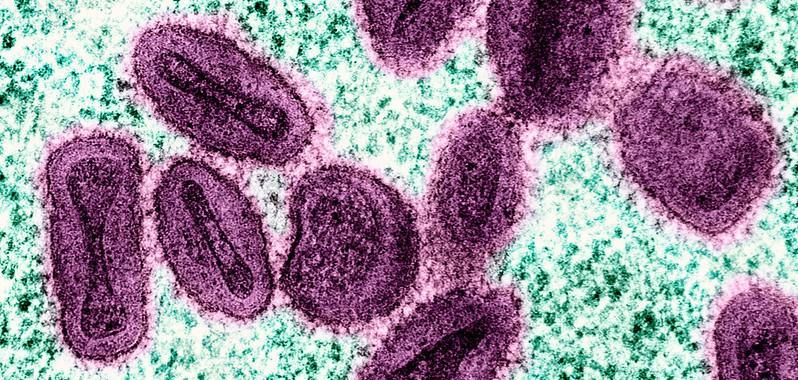 mpox virus