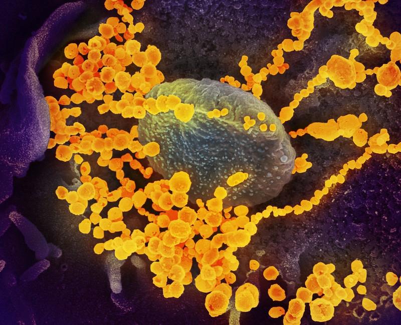 SARS-CoV-2 emerging from cell-NIAID