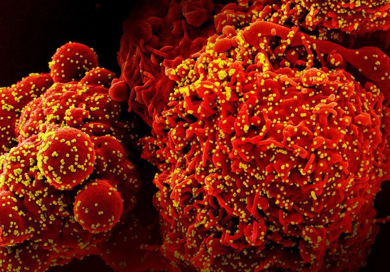 covid virus