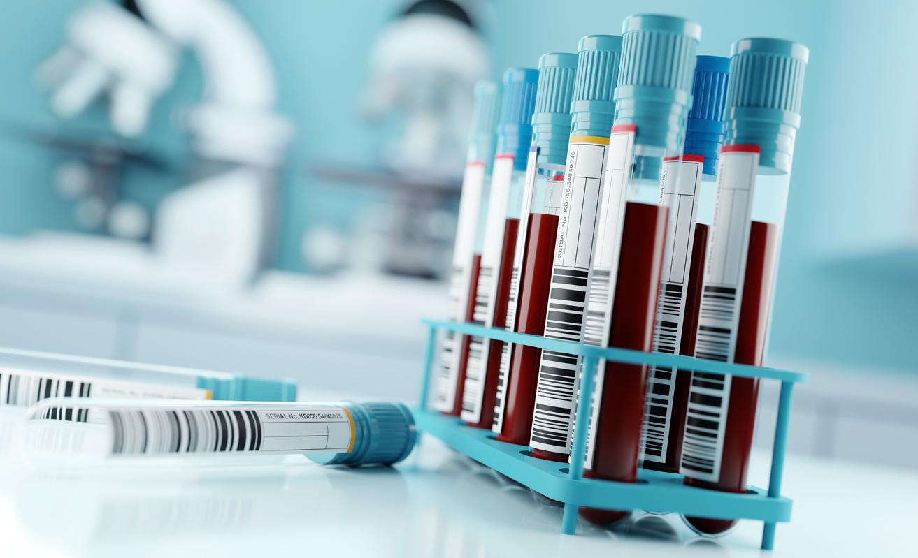 blood samples