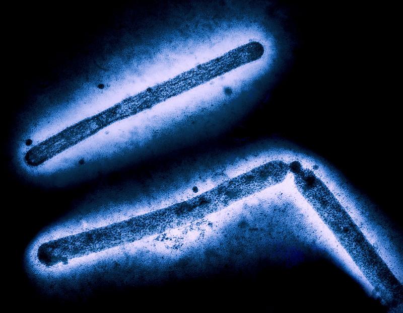 H5N1 virus