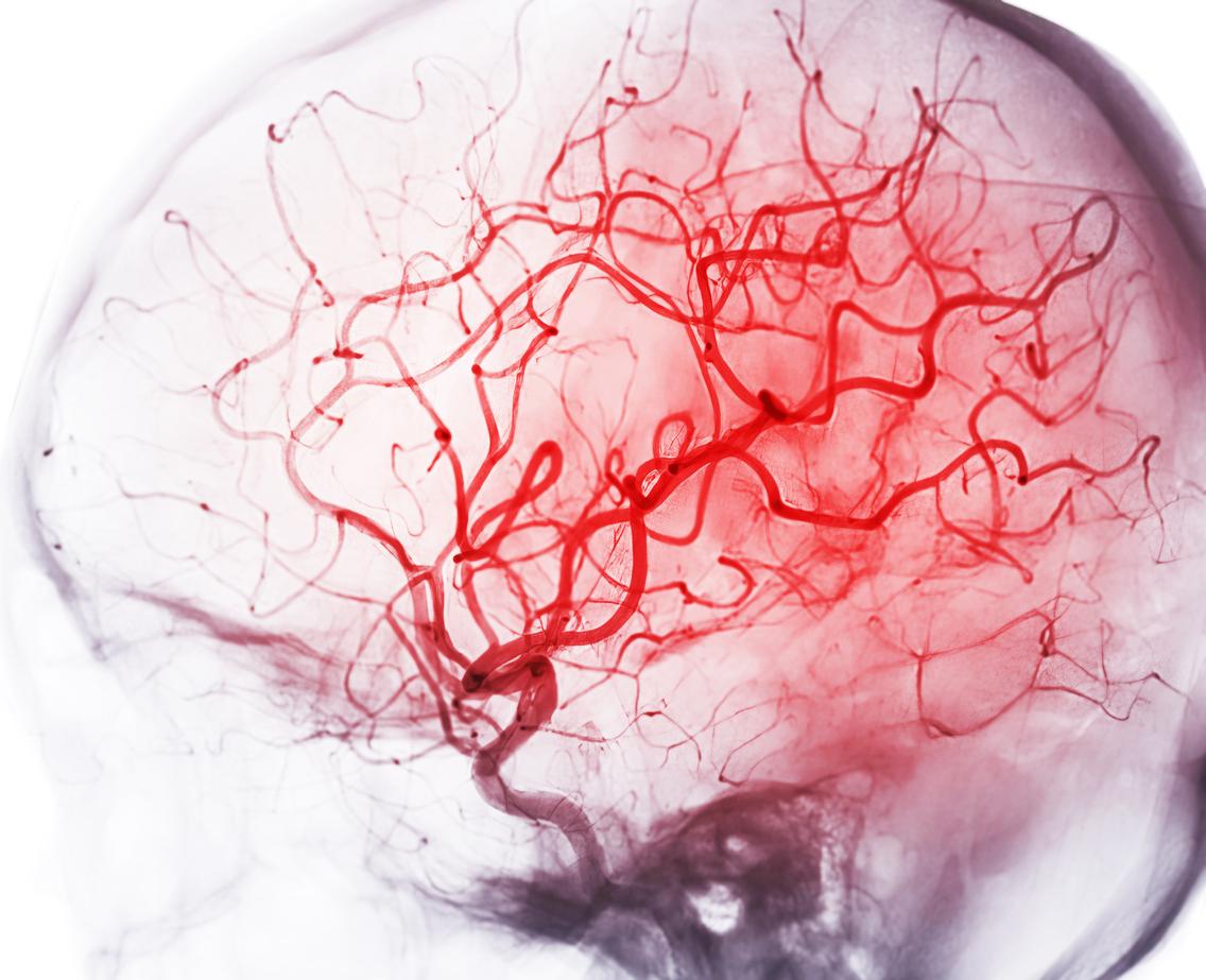 Frontiers  Caught in the thickness of brain fog: exploring the