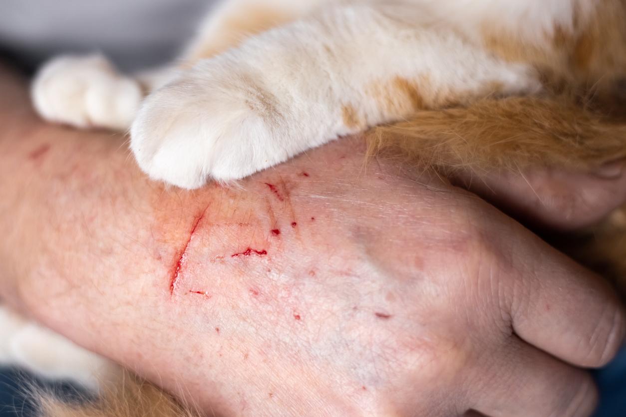猫抓
