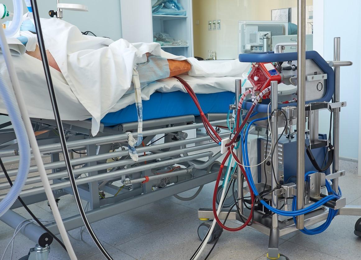 More than half of COVID-19 ECMO patients die in hospital, while