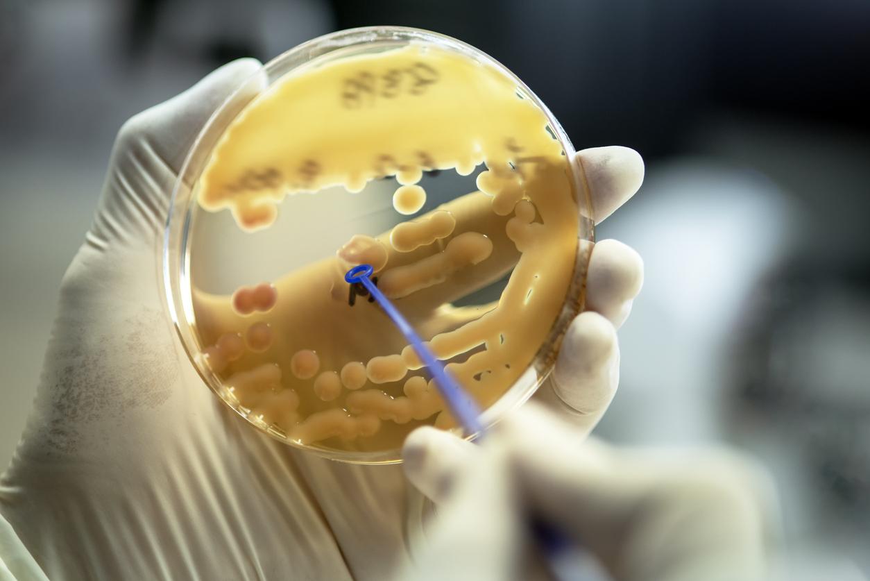 Klebsiella pneumoniae colonies