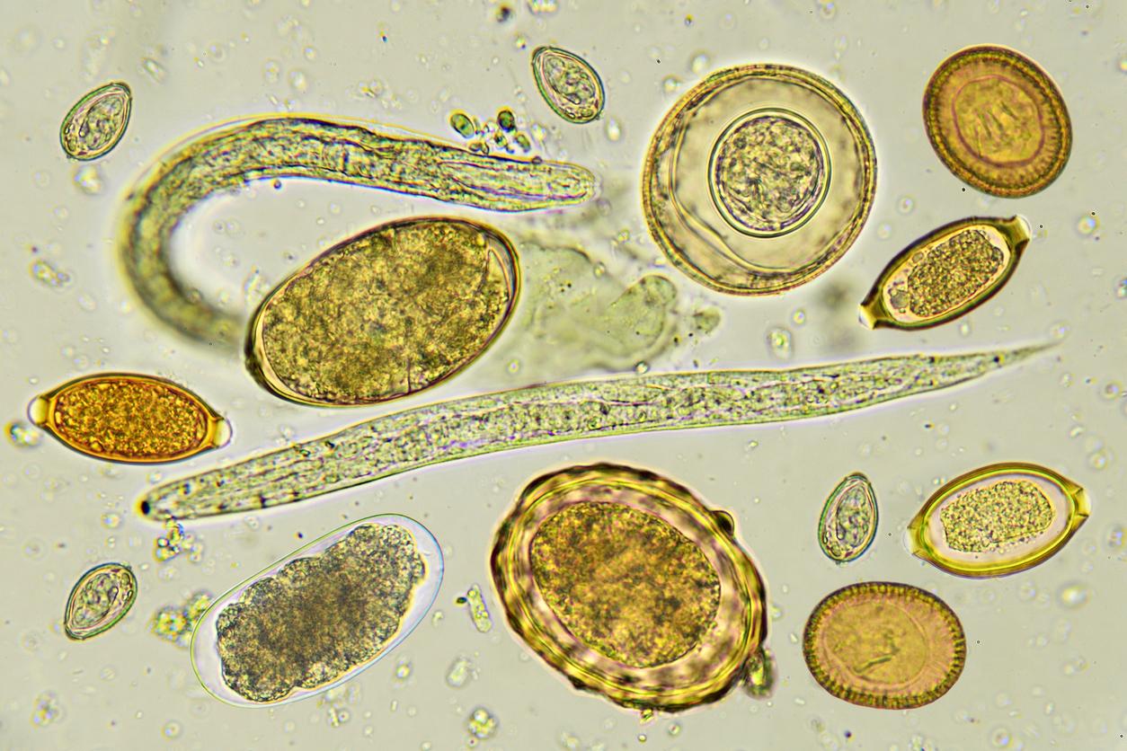 Helminths under microscope