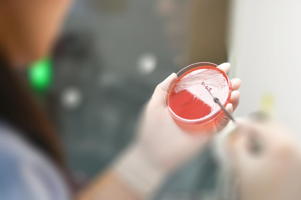 Blood culture