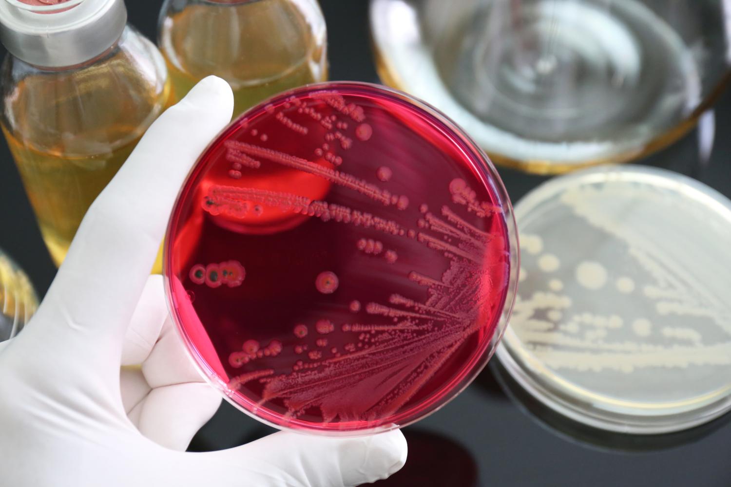 Salmonella in petri dish