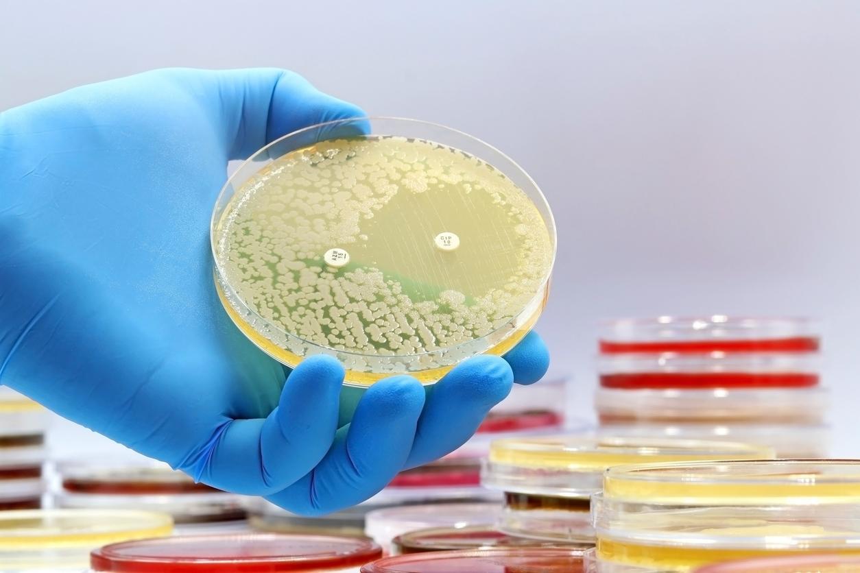 Resistant bacteria in petri dish