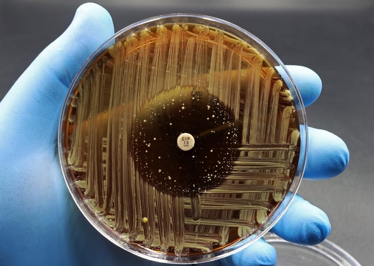 Resistant bacteria in petri dish