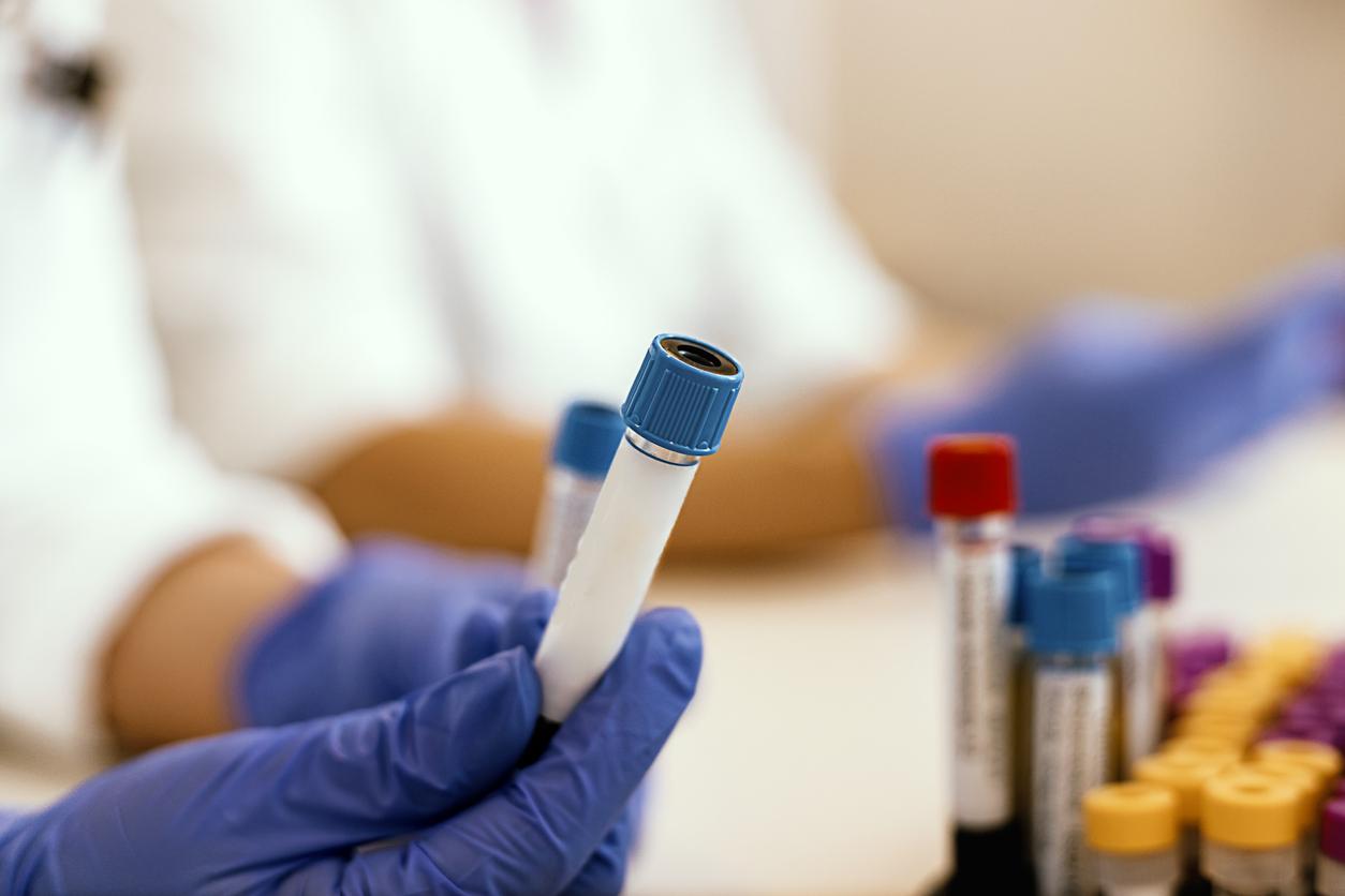 blood samples 
