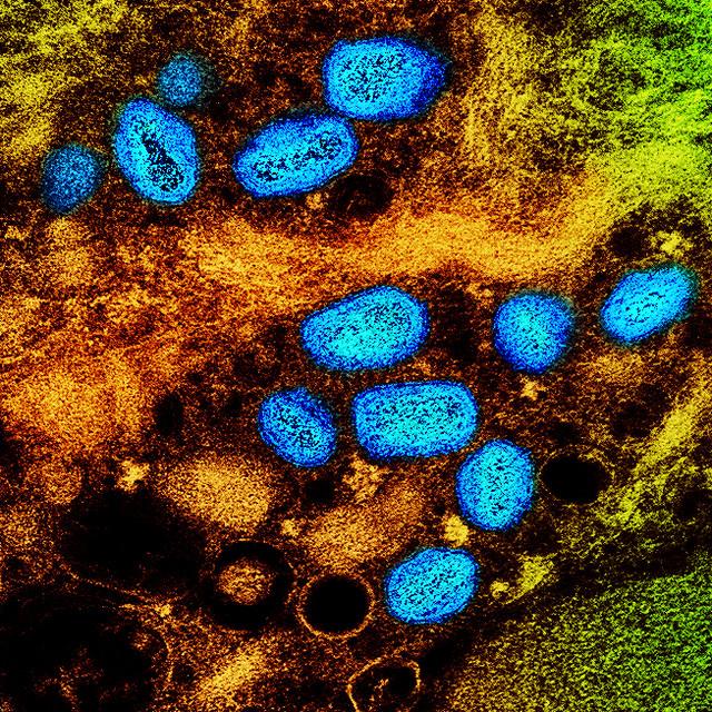 mpox blue brown