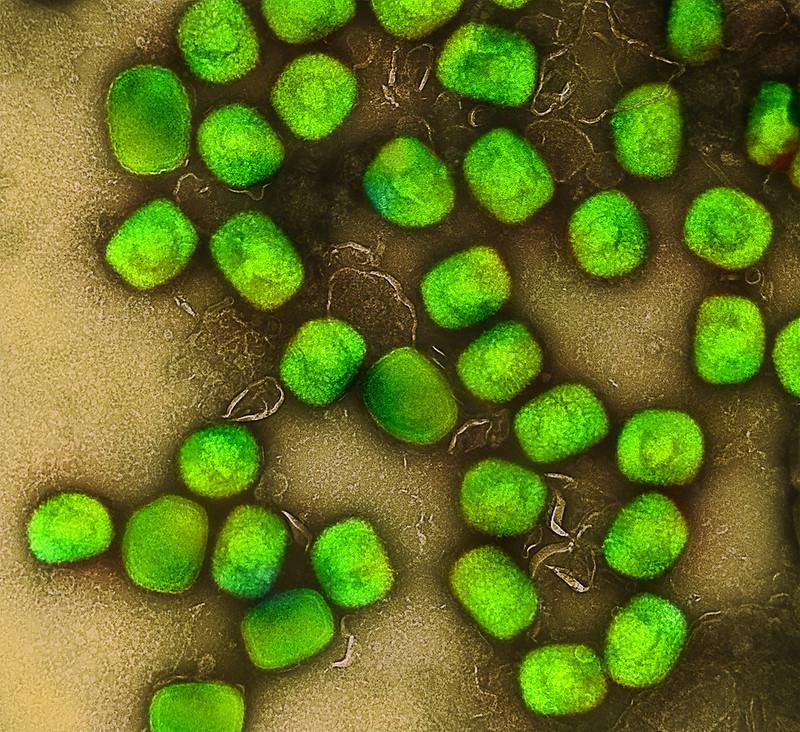 mpox virus green